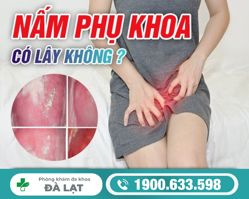 Hình ảnh minh họa